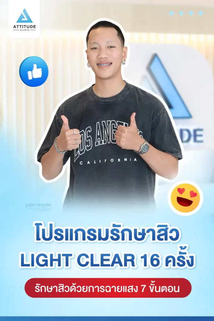 รีวิวรักษาสิวคุณเทม ด้วยการฉายแสง โปรแกรมรักษาสิว Light Clear 7 ขั้นตอน จำนวน 16 ครั้ง รักษาสิวอุดตัน สิวอักเสบ รอยแดงทั่วใบหน้าโดยเฉพาะบริเวณแก้ม 2 ข้างที่ Attitude Clinic