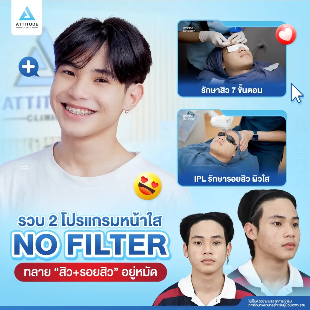รวบ 2 โปรแกรมหน้าใสแบบไม่ง้อฟิลเตอร์ Step ทลายสิว และรอยสิวอยู่หมัด