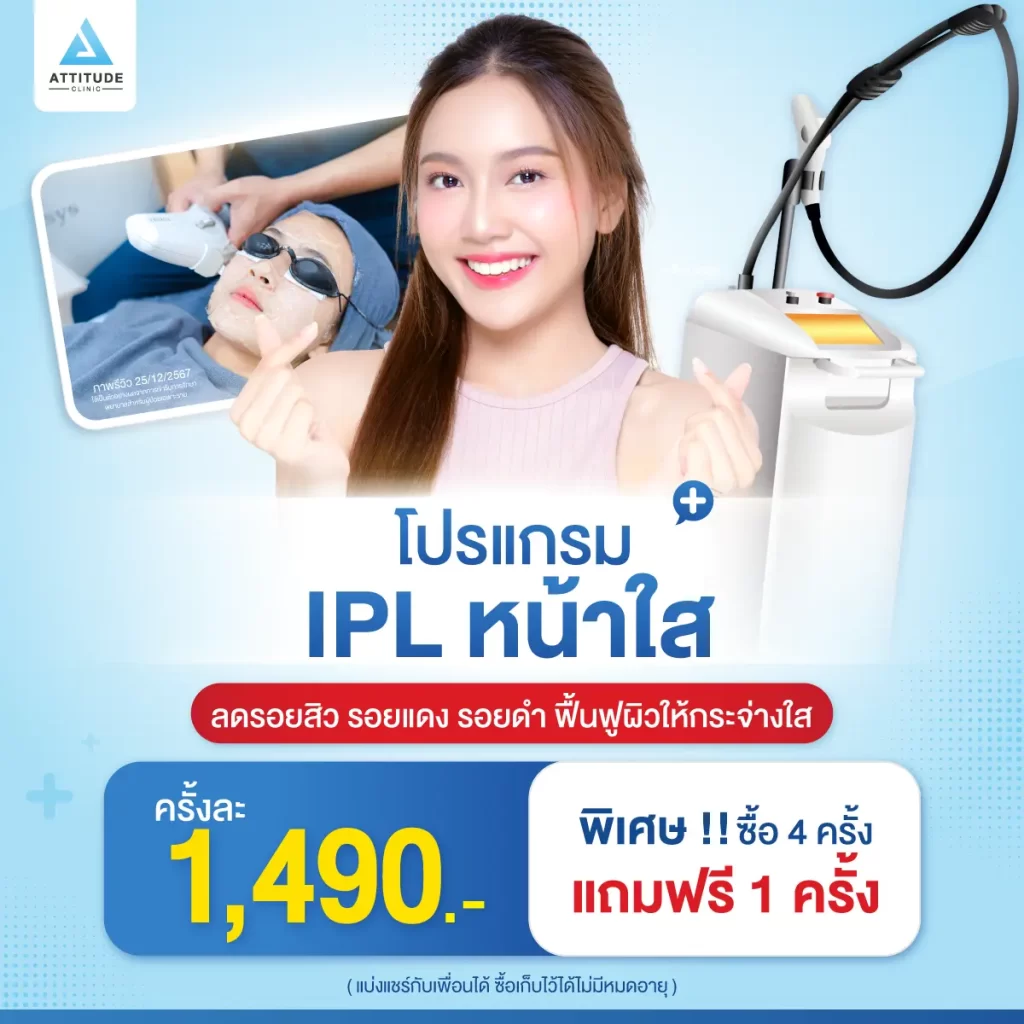 [โปรโมชั่น] หน้าใสโดนใจสุดๆ โปรแกรม IPL ลดรอยสิว รอยแดง รอยดำ กระชับรูขุมขน ฟื้นฟูผิวหมองคล้ำให้กลับมากระจ่างใส เลเซอร์แบบชิลๆ ไม่ต้องพักฟื้นที่ Attitude Clinic