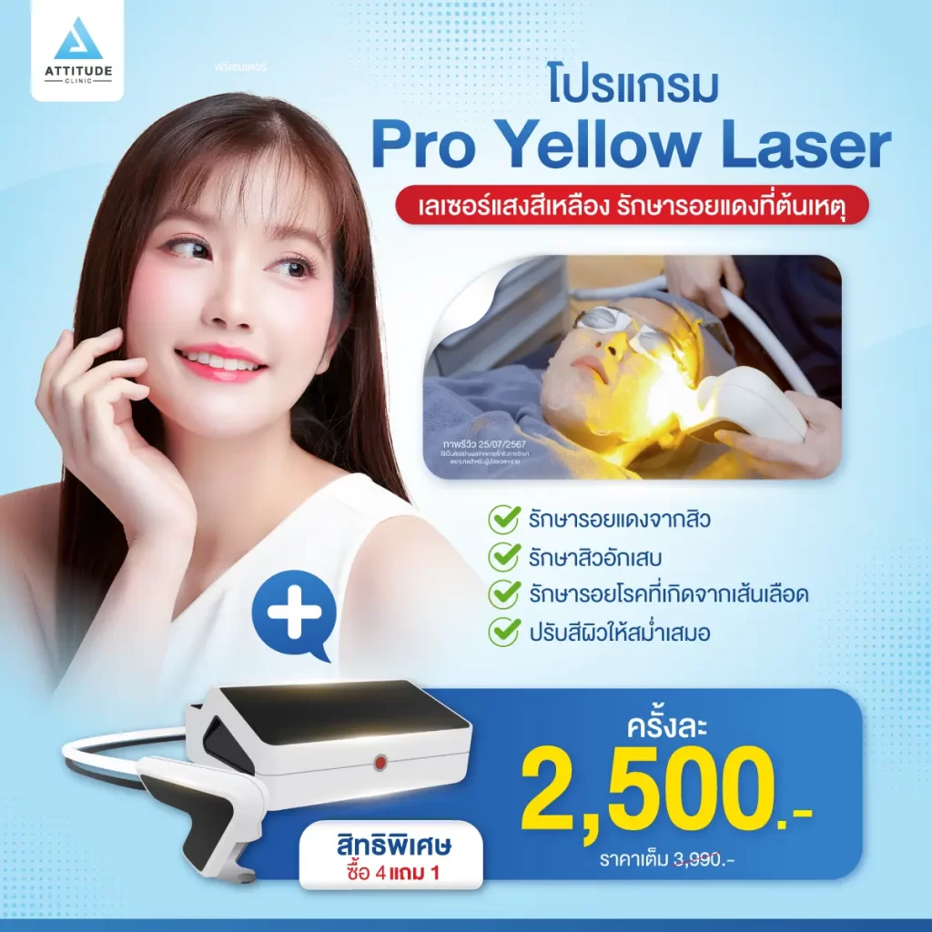 [โปรโมชั่นรักษารอยแดง] ทำไมต้องรักษารอยแดงและสิวอักเสบด้วยเลเซอร์สีเหลือง?