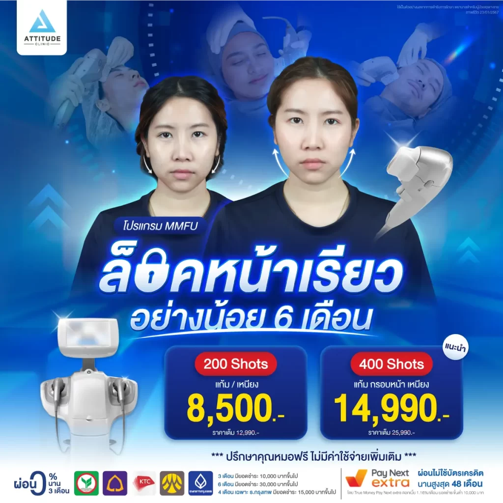 ล็อคหน้าเรียวอย่างน้อย 6 เดือนด้วยโปรแกรมยกกระชับใบหน้า MMFU ออกแบบการรักษาโดยคุณหมอทุกเคสที่แอททิจูด