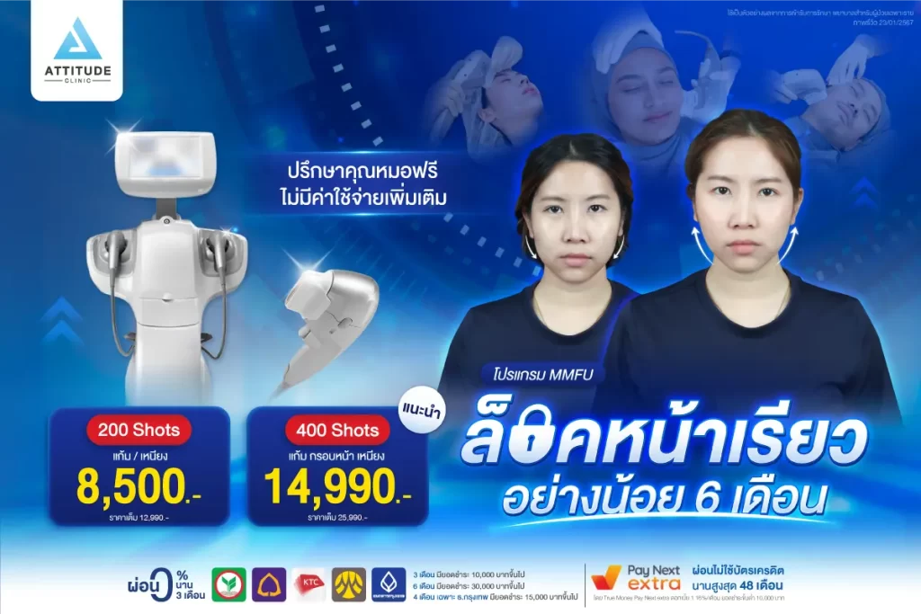 ล็อคหน้าเรียวอย่างน้อย 6 เดือนด้วยโปรแกรมยกกระชับใบหน้า MMFU ออกแบบการรักษาโดยคุณหมอทุกเคสที่แอททิจูด