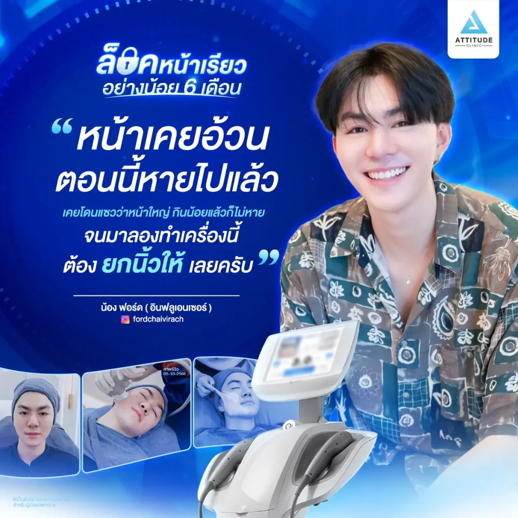 ยืนยันอีก 1 เสียงว่าผู้ชายก็ทำได้ ล็อคหน้าเรียวอย่างน้อย 6 เดือนด้วยโปรแกรมยกกระชับใบหน้า MMFU