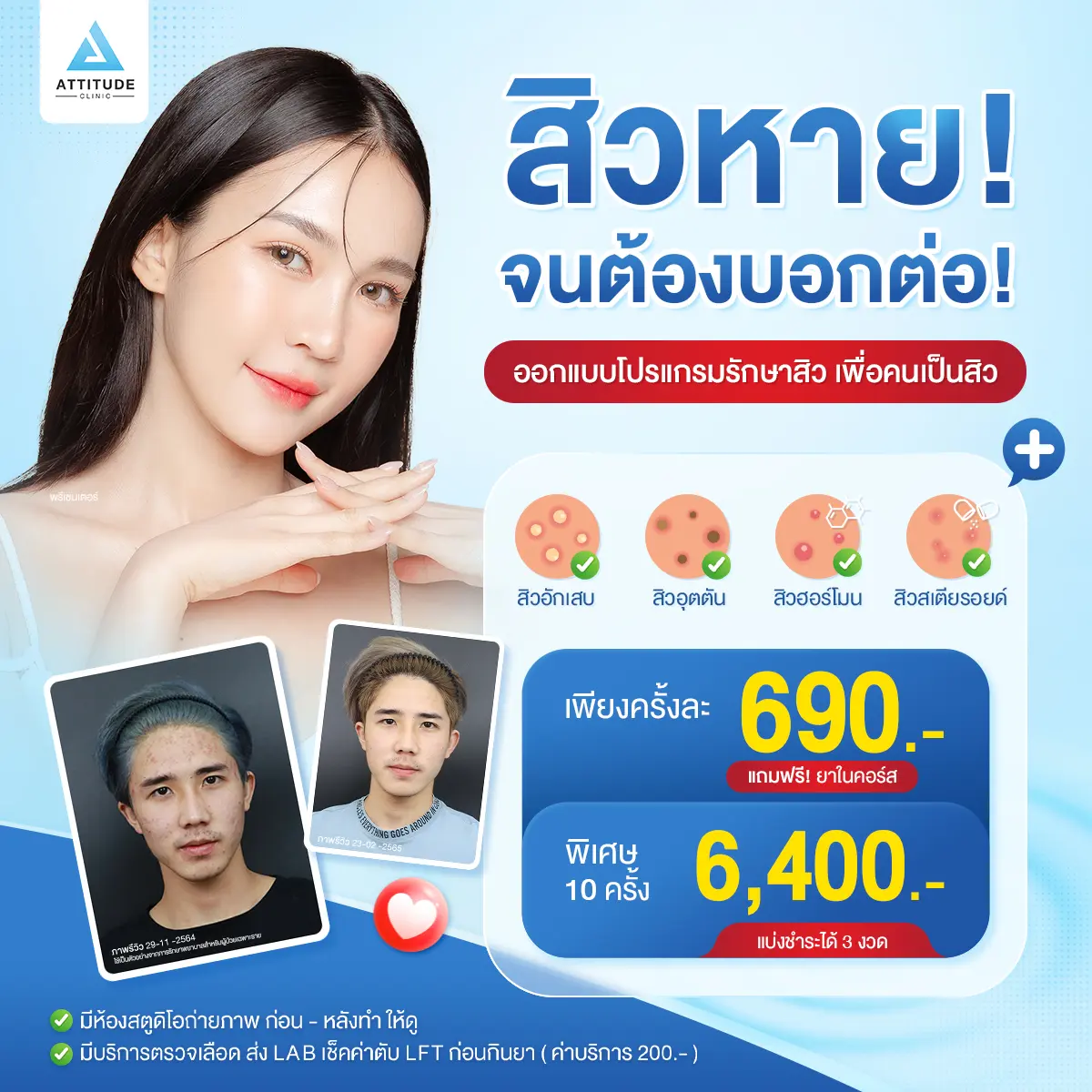 เป็นสิวทำไมต้องทน [งบ 690.- ก็รักษาสิวได้] ไม่ว่าคุณจะเป็นสิวหนักแค่ไหน สิวอักเสบ สิวอุดตัน สิวฮอร์โมน สิวสเตียรอยด์ ให้เราดูแลด้วยโปรแกรม Anti Acne รักษาสิวจากต้นเหตุ ดูแลโดยคุณหมอทุกเคส
