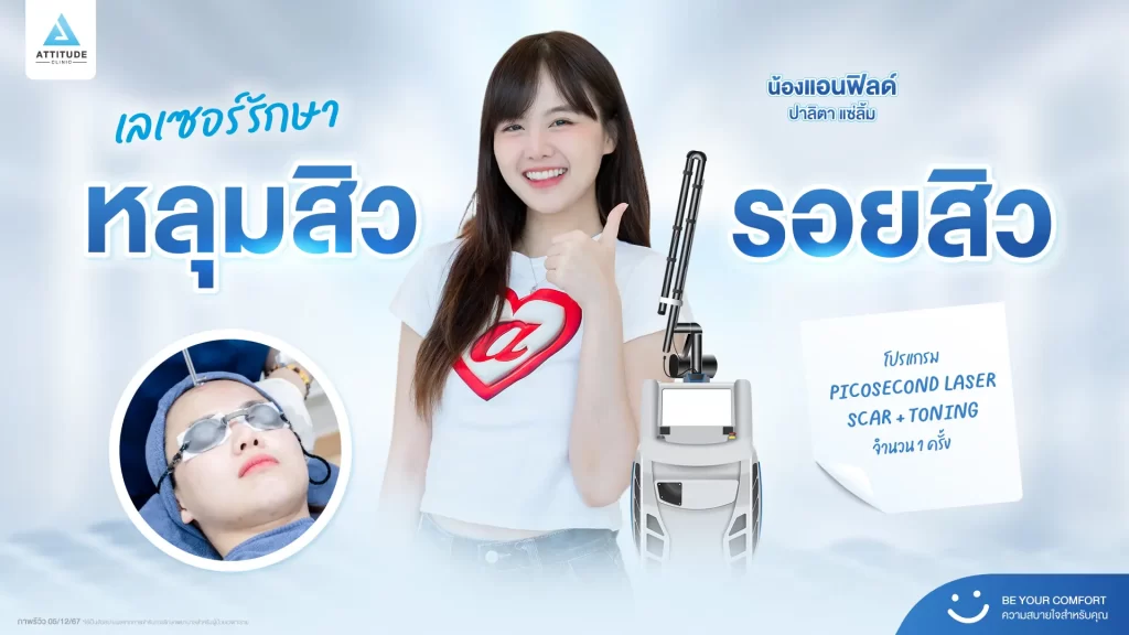 น้องกันเองพามาส่องรีวิว รอบนี้เป็นคิวของพี่แอนฟิลด์มาทำโปรแกรม Picosecond Laser รีวิวเลเซอร์ครั้งแรกที่ Attitude Clinic ค้าบ~