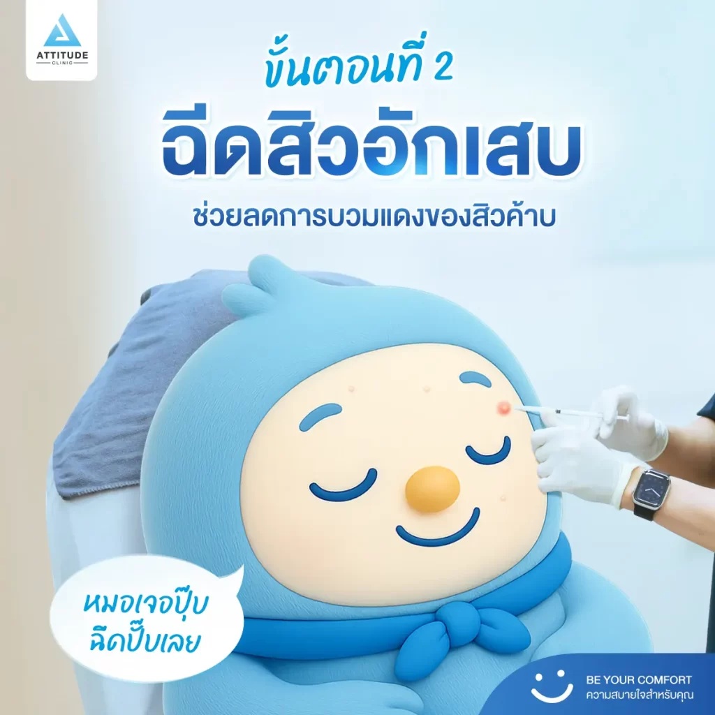อยากสิวหาย สบายใจต้องทำยังไง ?! น้องกันเองพาไปหาคำตอบในโพสต์นี้ค้าบ