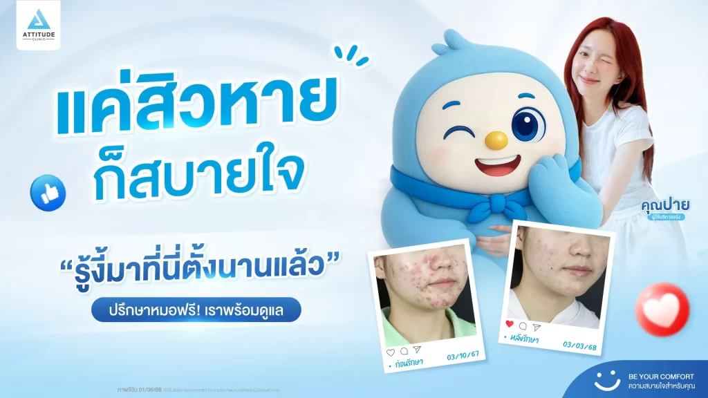  แค่สิวหาย ก็สบายใจแล้ว น้องกันเองคอนเฟิร์มจากพี่ๆ ที่เข้ามารักษาสิวที่แอททิจูดคลินิกบอกเป็นเสียงเดียวกันว่า "รู้งี้มารักษาสิวที่นี่ตั้งนานแล้ว"