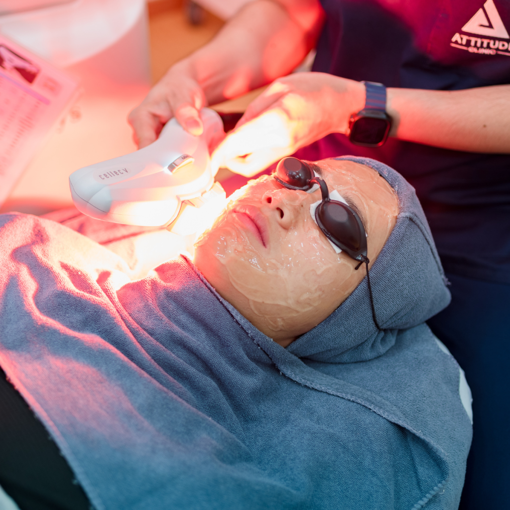หมดวัน หมดโปร! 9.9 LASER DAY ⚡ แอททิจูดเล่นใหญ่! มัดรวม 6 เครื่องเลเซอร์ขายดี [ ซื้อ 2 แถม 1 ] คุณหมอดูแลเองทุกเคส