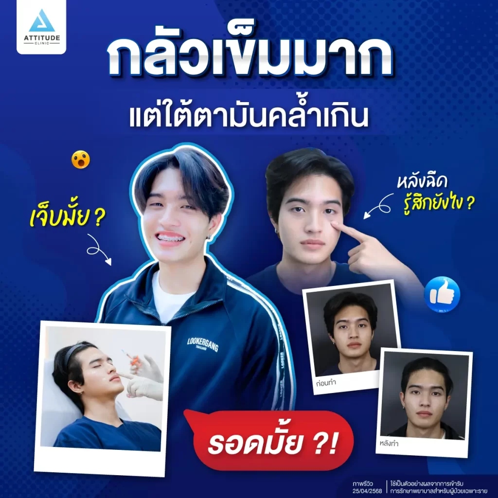 กลัวเข็มมากแต่ใต้ตาคล้ำ ถ่ายรูปมุมไหนก็ไม่มั่นใจ จนได้เจอโปรแกรมฉีดฟิลเลอร์ที่ Attitude Clinic