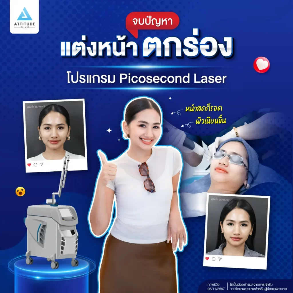 หน้าไม่เนียน แต่งหน้าไม่ติด ปัญหาใหญ่ของพี่คนสวยที่แก้ไขด้วยโปรแกรม Picosecond Laser