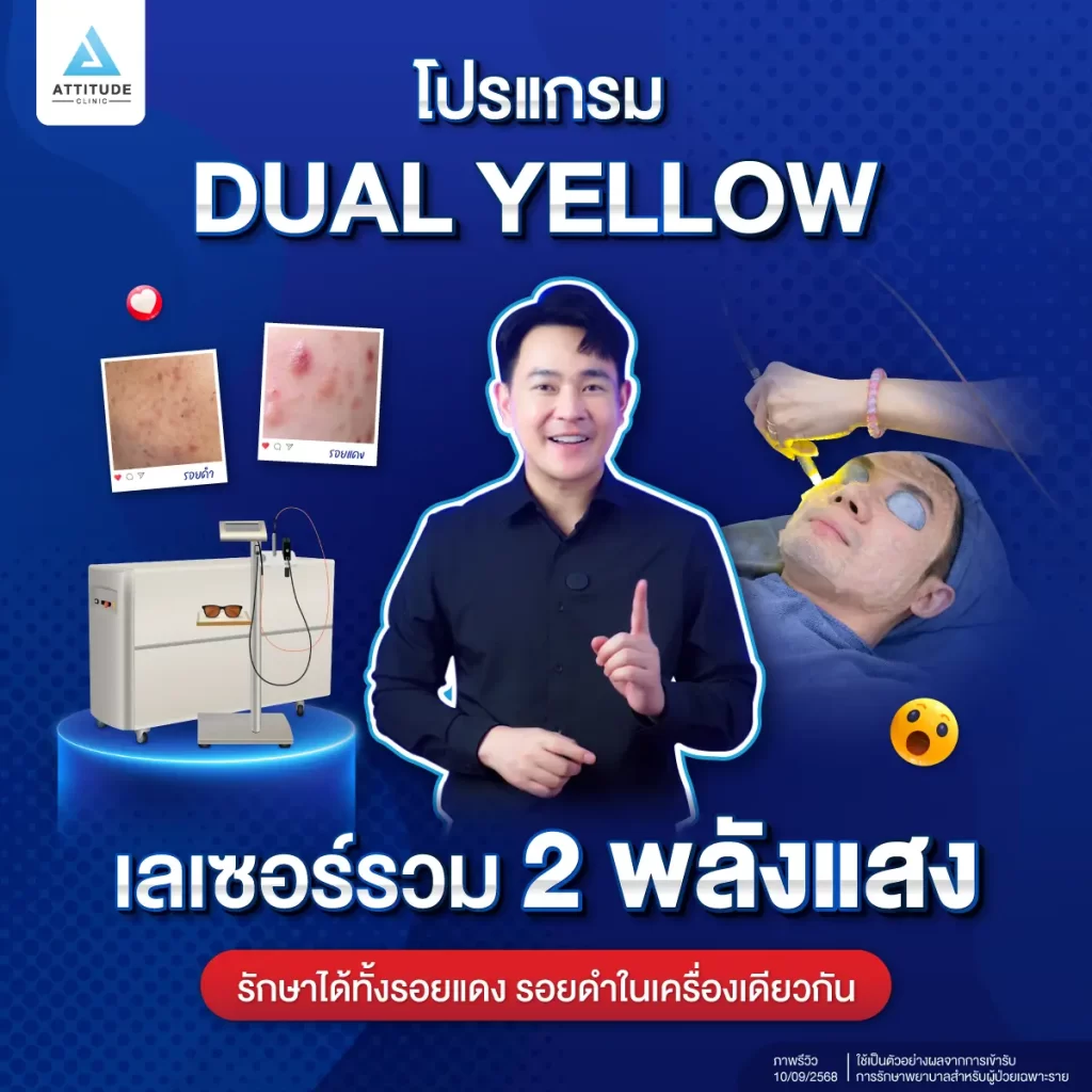 แนะนำ! เลเซอร์หน้าใสรวม 2 พลังแสงในเครื่องเดียว โปรแกรม Dual Yellow Laser ตัวจบปัญหารอยดำ รอยแดง