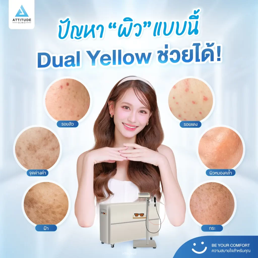 ว้าวจนอยากบอกต่อ! โปรแกรม Dual Yellow Laser เลเซอร์หน้าใสประจำ Attitude Clinic ทำเสร็จไม่ต้องพักหน้า ออกงานได้เลยชิว ๆ