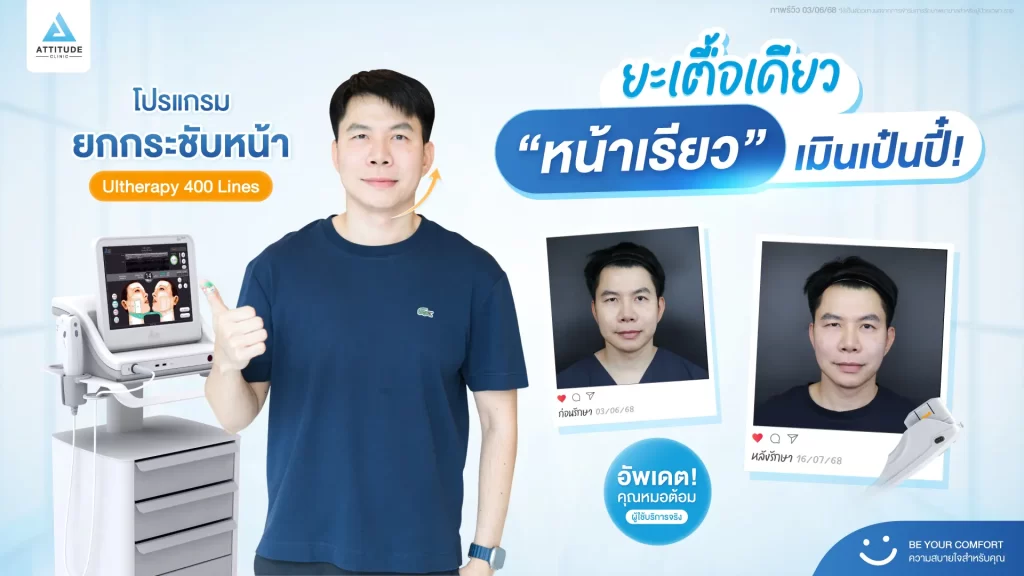 ยะเตื้อเดียว ‘หน้าเรียว’ เมินเป๋นปี๋! น้องกันเองพาส่องรีวิวโปรแกรม Ultherapy 400 Lines ของหมอต้อม ที่ Attitude Clinic กันครับ