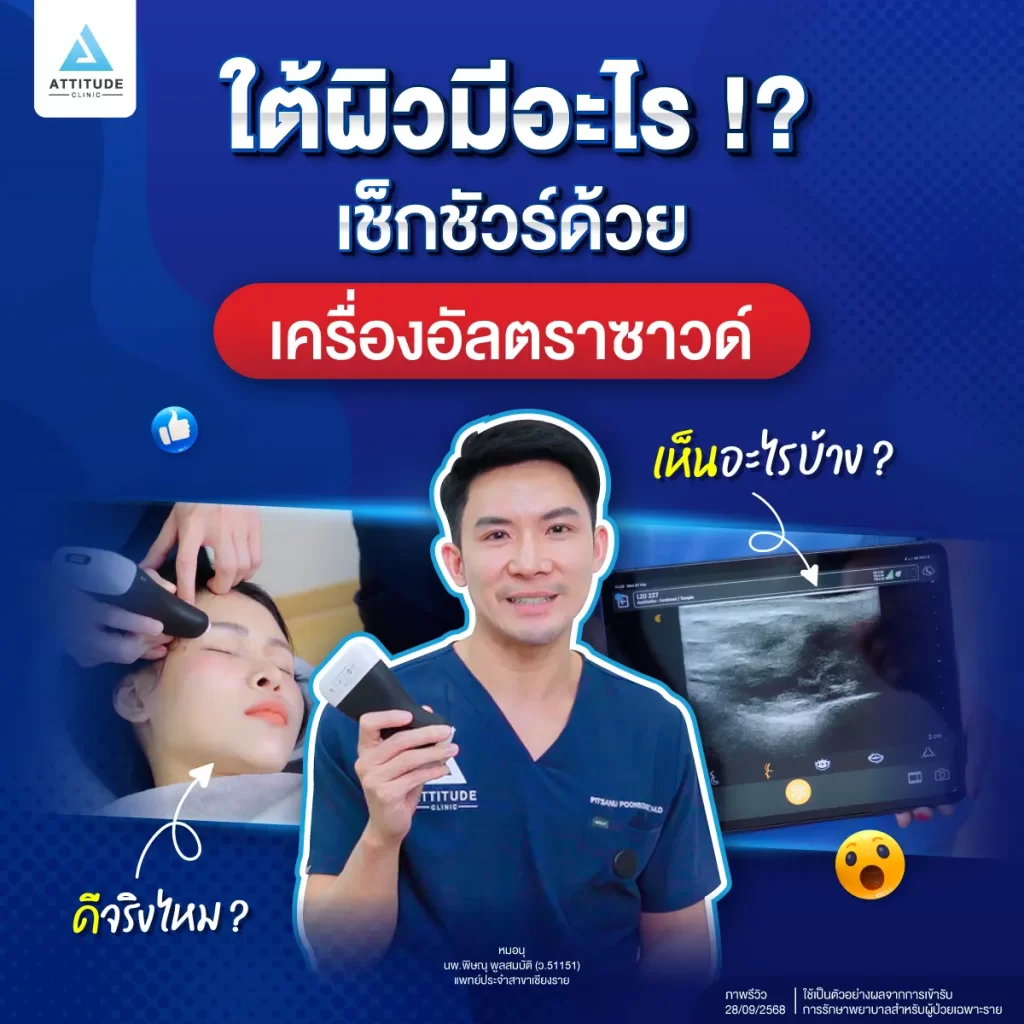 เครื่องอัลตราซาวด์ผิว