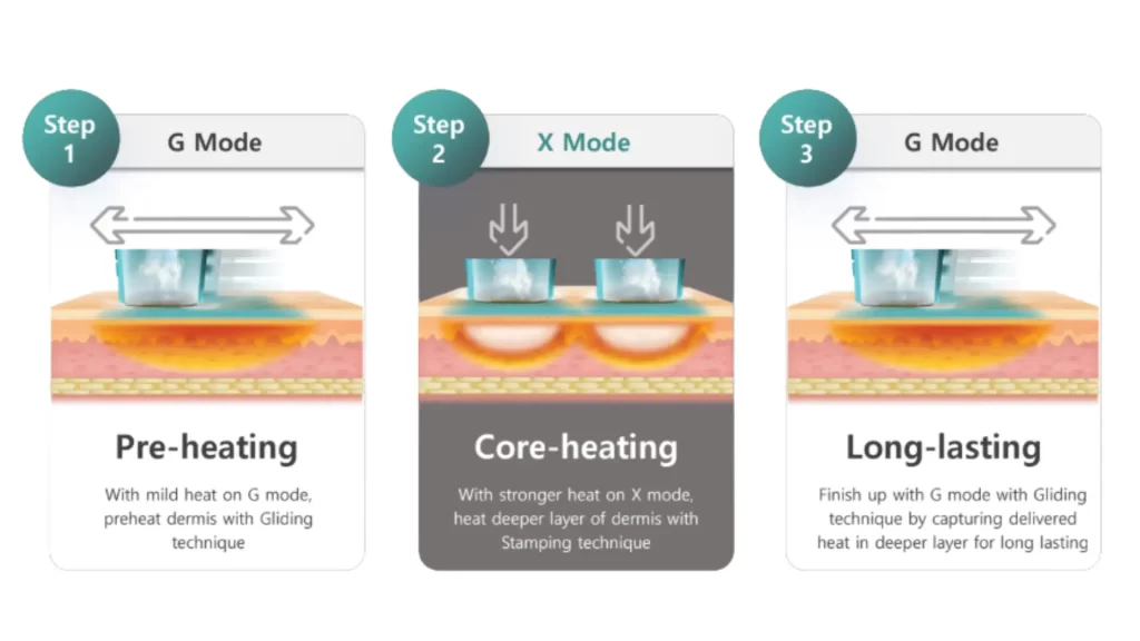 ข้อมูลครบ!! Oligio X ที่เชียงราย ,Oligio X ที่ห้วยขวาง เทคโนโลยียกกระชับผิวรุ่นใหม่ล่าสุด เย็น-ยุบ-ยก-นานมากขึ้นกว่ารุ่นเดิม!