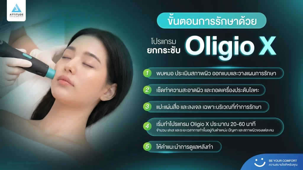 ข้อมูลครบ!! ทำความรู้จักโปรแกรมยกกระชับผิว Oligio X รุ่นใหม่ล่าสุด เย็น-ยุบ-ยก-นานมากขึ้นกว่ารุ่นเดิม! พร้อมเปิดตัวโปรแกรมยกกระชับผิว Oligio X ที่เชียงราย และ Oligio X ที่ลำปาง