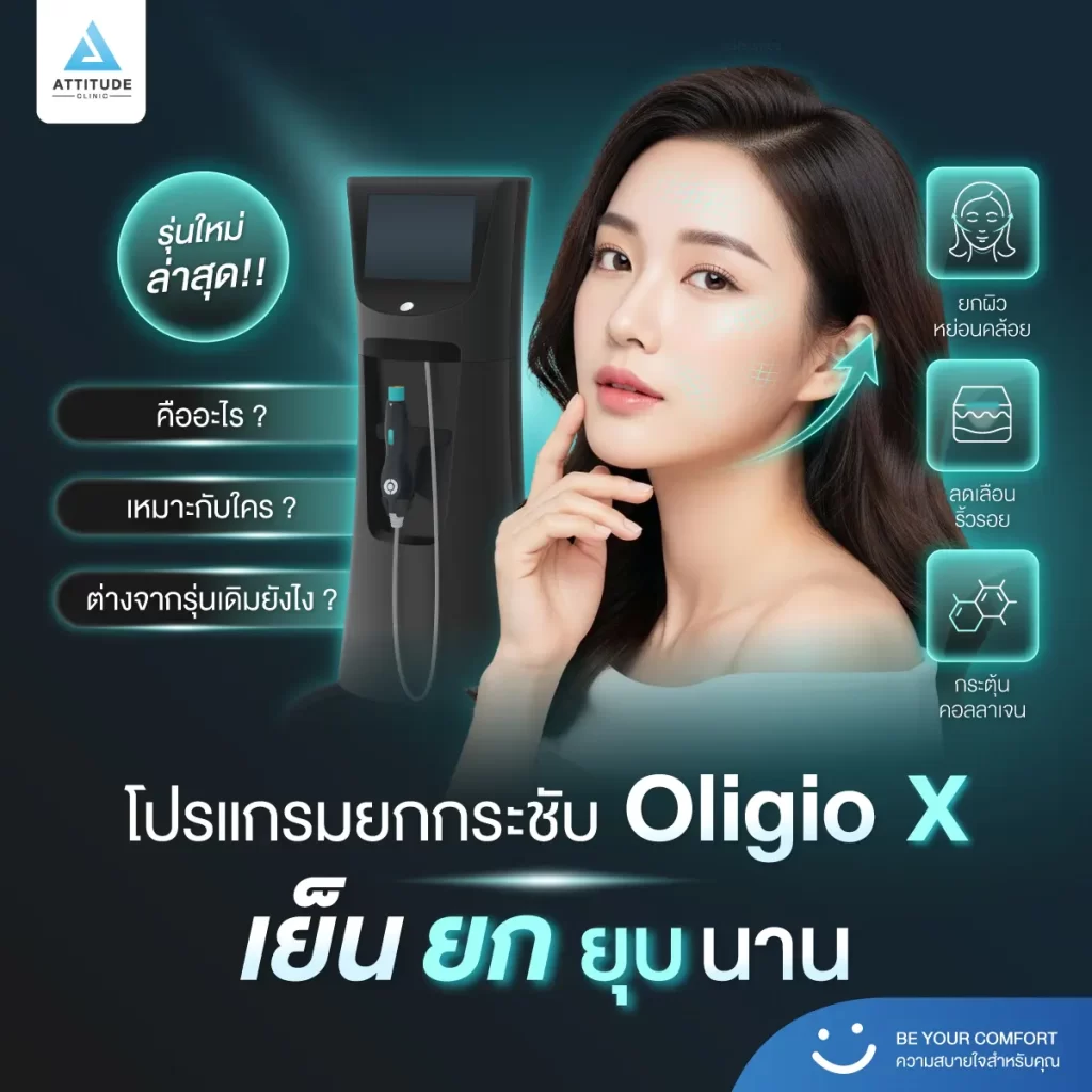 ข้อมูลครบ!! ทำความรู้จักโปรแกรมยกกระชับผิว Oligio X รุ่นใหม่ล่าสุด เย็น-ยุบ-ยก-นานมากขึ้นกว่ารุ่นเดิม! พร้อมเปิดตัวโปรแกรมยกกระชับผิว Oligio X ที่เชียงราย และ Oligio X ที่ลำปาง