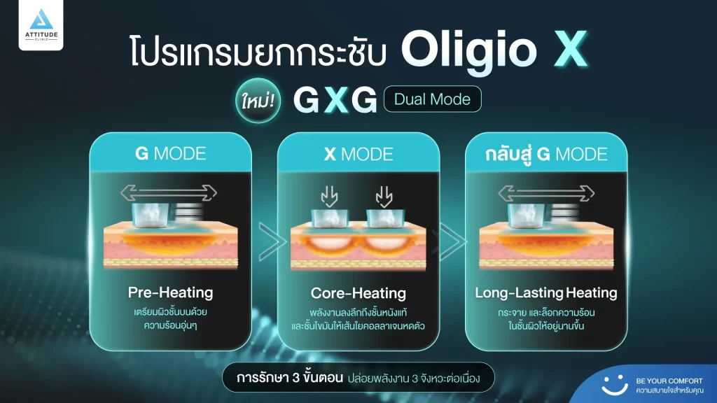 ข้อมูลครบ!! ทำความรู้จักโปรแกรมยกกระชับผิว Oligio X รุ่นใหม่ล่าสุด เย็น-ยุบ-ยก-นานมากขึ้นกว่ารุ่นเดิม! พร้อมเปิดตัวโปรแกรมยกกระชับผิว Oligio X ที่เชียงราย และ Oligio X ที่ลำปาง