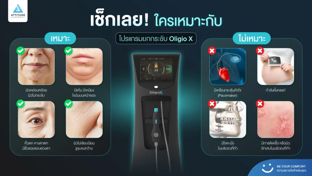 ข้อมูลครบ!! ทำความรู้จักโปรแกรมยกกระชับผิว Oligio X รุ่นใหม่ล่าสุด เย็น-ยุบ-ยก-นานมากขึ้นกว่ารุ่นเดิม! พร้อมเปิดตัวโปรแกรมยกกระชับผิว Oligio X ที่เชียงราย และ Oligio X ที่ลำปาง