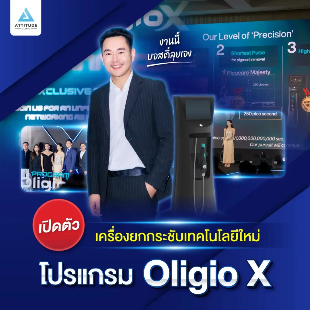 เปิดตัวเครื่องใหม่! โปรแกรม OLIGIO X เทคโนโลยียกกระชับรุ่นใหม่ล่าสุดที่ ATTITUDE CLINIC