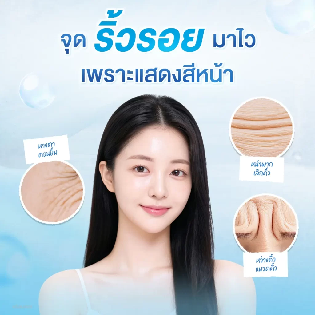 ริ้วรอย…ไม่ได้มาจากอายุเสมอไป รู้ก่อนป้องกันได้ก่อนวัย 30