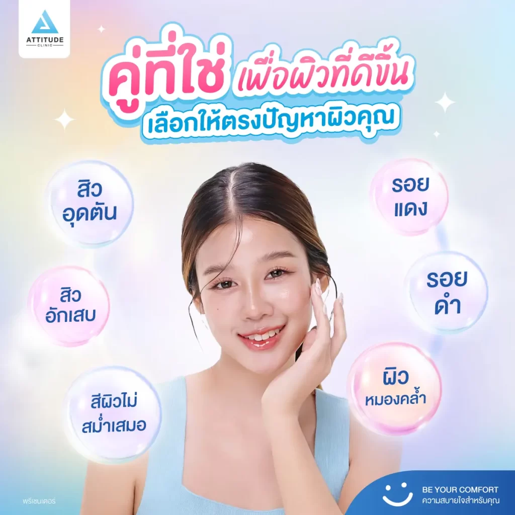 วาเลนไทน์นี้อยากหน้าเนียนใส สิวไม่กวนใจก่อนออกเดท มาหา “คู่ที่ใช่” รักษาสิว รอยสิวกัน