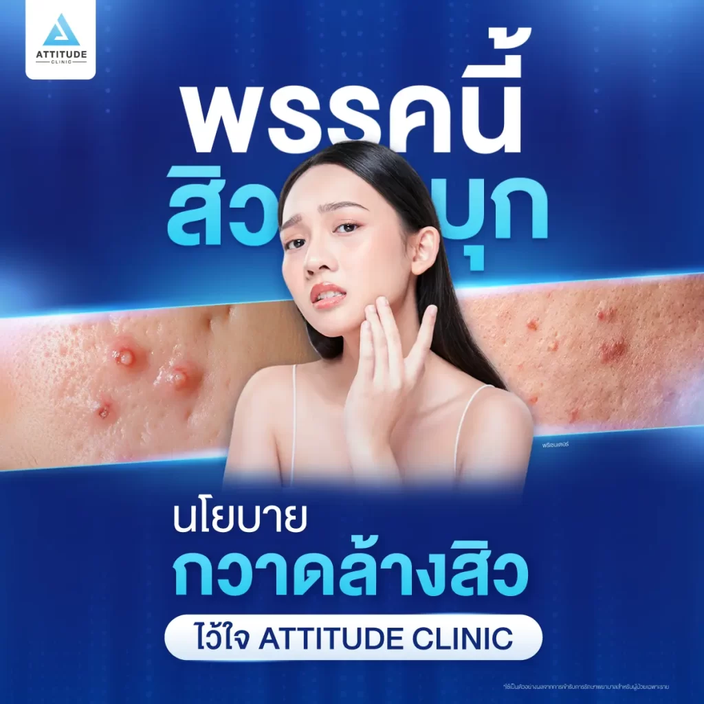 นโยบายกวาดล้างสิว ไว้ใจให้ Attitude Clinic ดูแล