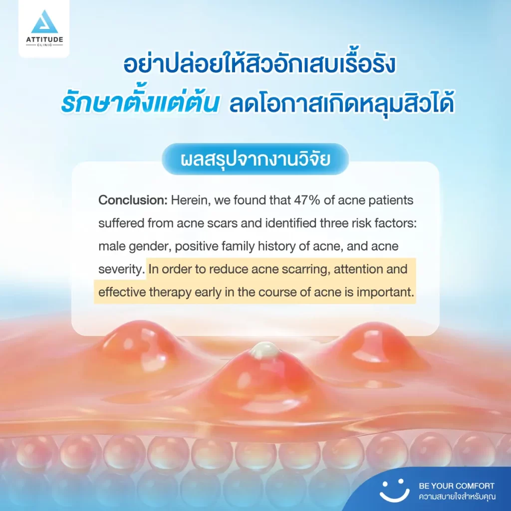 สิวอักเสบ 7 วันแรก ชี้ชะตาอนาคตผิวได้จริงไหม !? คำถามนี้ งานวิจัยมีคำตอบให้ครับ