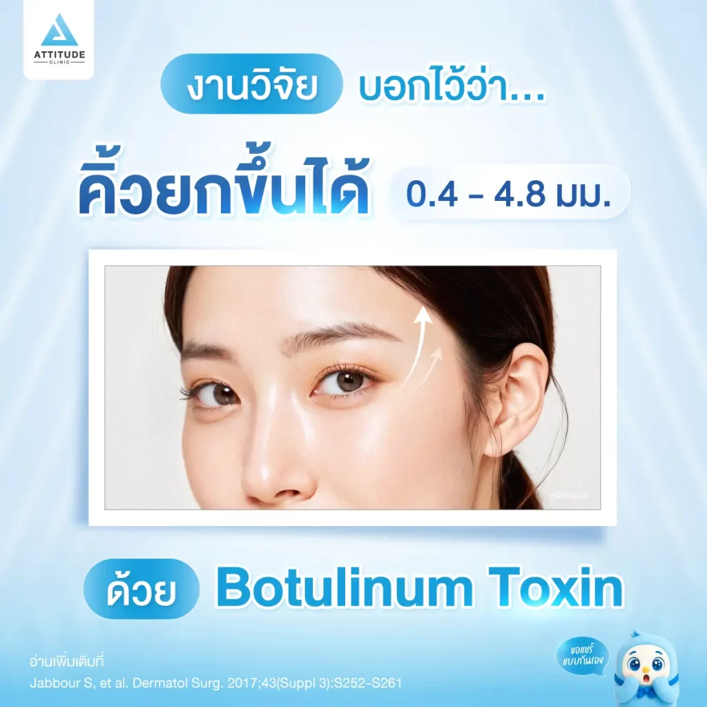 Botulinum Toxin ช่วยยกคิ้วได้ 0.4 - 4.8 มม. จริงไหมมีคำตอบ!