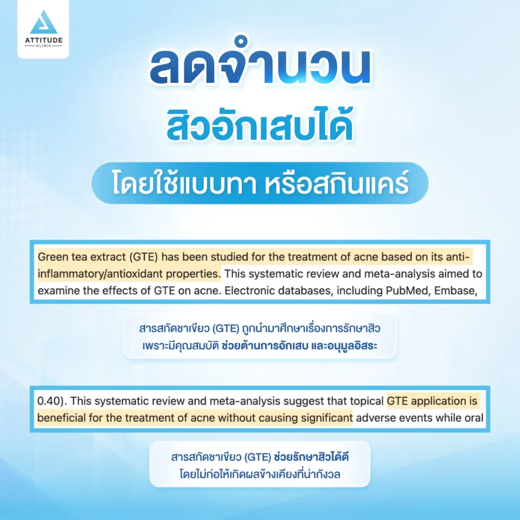 สาวกชาเขียวรู้หรือไม่ ชาเขียวช่วยลดสิวอักเสบ!