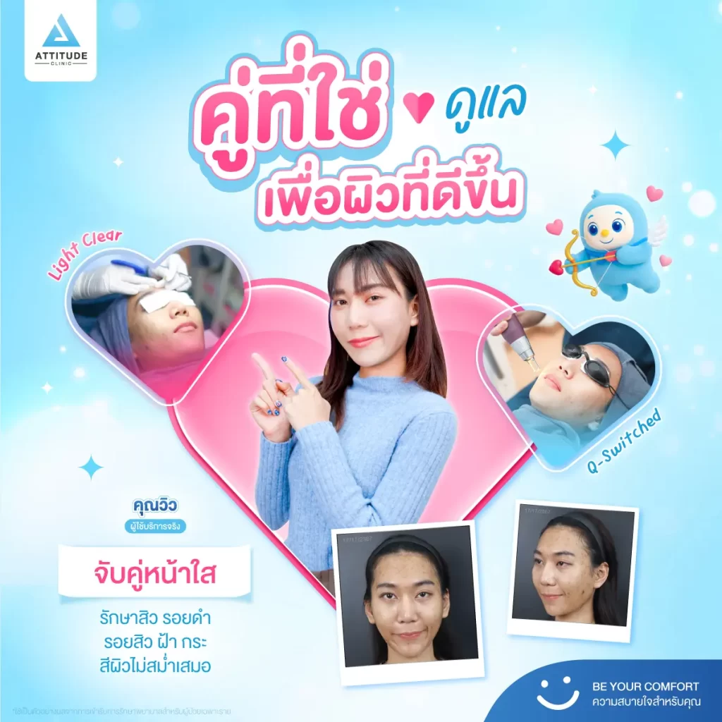 อยากหน้าใสไปเดทวาเลนไทน์ ต้องรู้ก่อนว่า “คู่ที่ใช่” สำหรับผิวเราเป็นแบบไหน