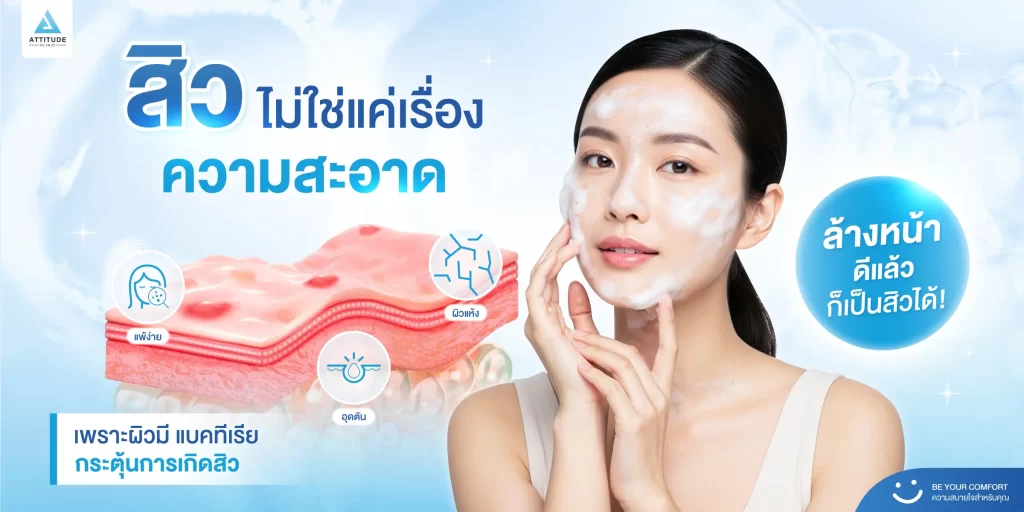 ล้างหน้าดีแล้ว แต่ก็ยังเป็นสิวซ้ำซาก… เพราะสิวไม่ใช่เรื่องของความสะอาดแค่อย่างเดียวน่ะสิครับ!