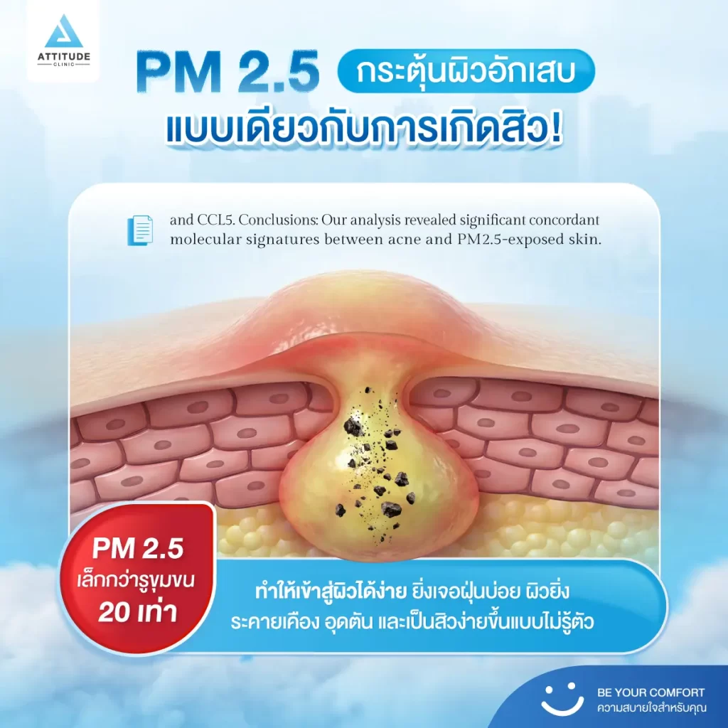 PM 2.5 ตัวการ “ซ้ำเติมสิว” ที่หลายคนไม่รู้ตัว