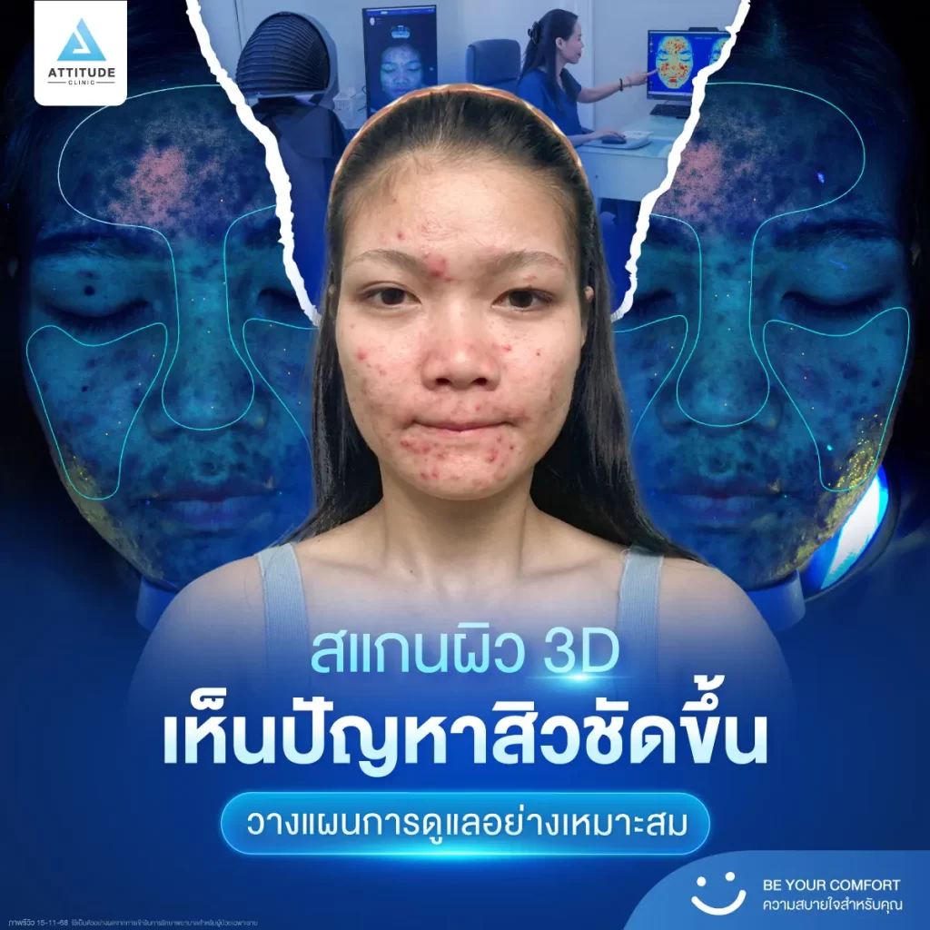 ไม่ว่าจะทำหัตถการไหน เราให้คุณ ‘สแกนผิว’ ก่อนเสมอ