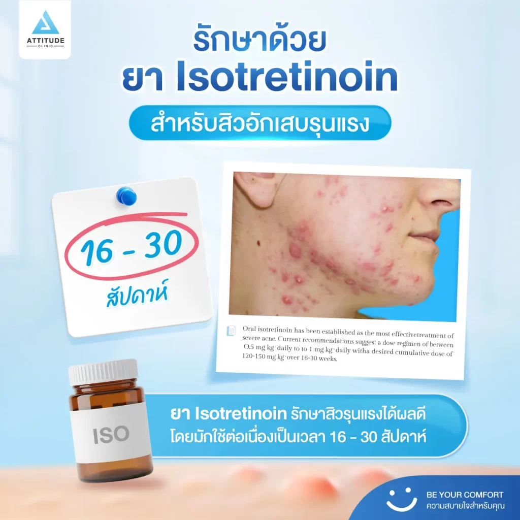 รักษาสิวกี่ครั้งหาย ? กี่ครั้งจบ ? งานวิจัยมีคำตอบ