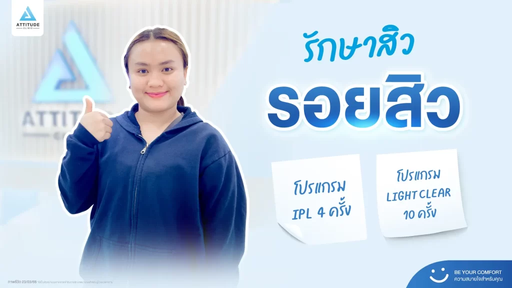 รีวิวรักษาสิวพี่แป้ง โปรแกรม Light Clear รักษาสิวด้วยการฉายแสง จำนวน 10 ครั้ง ต่อด้วยโปรแกรม IPL รักษารอยสิว จำนวน 4 ครั้งที่ Attitude Clinic