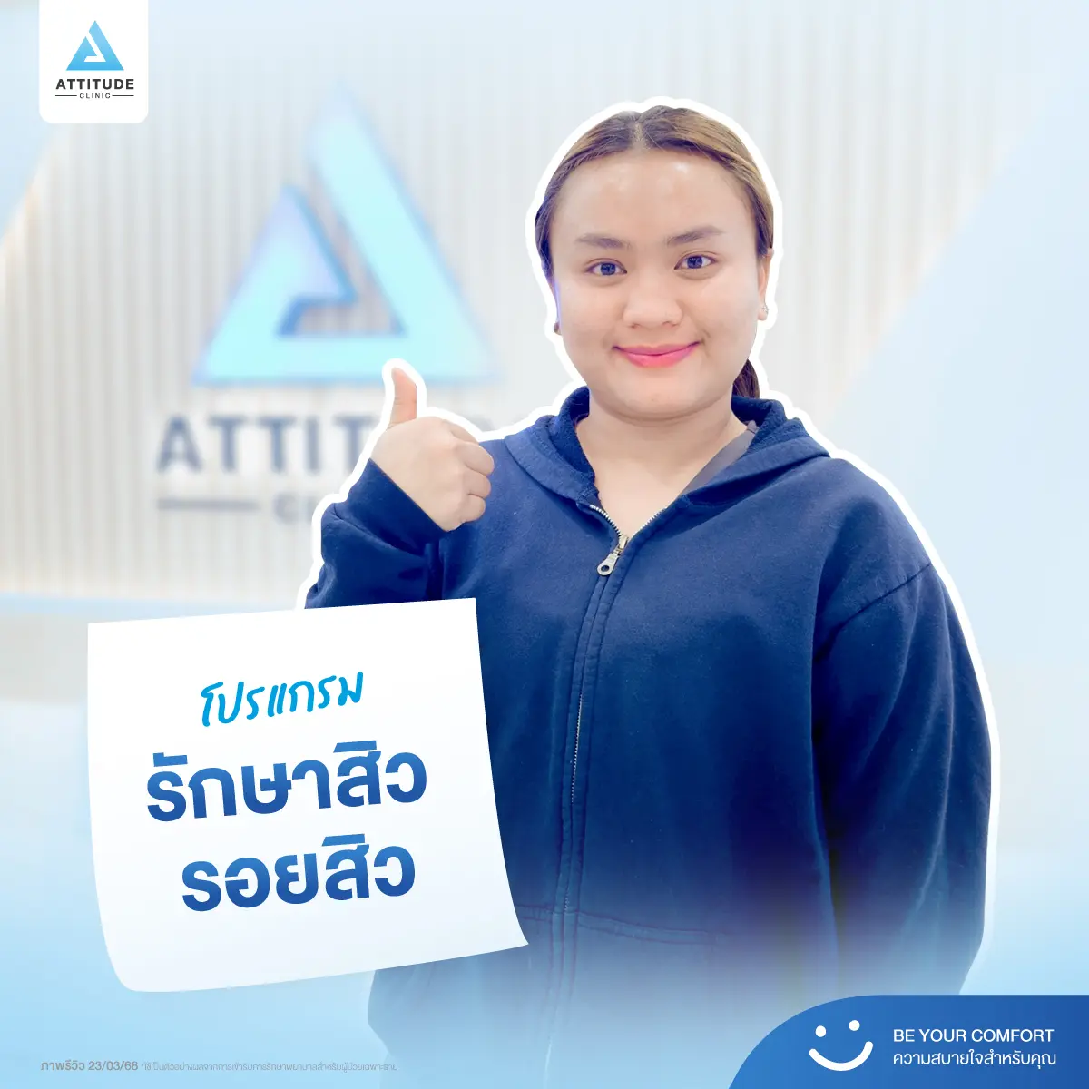 รีวิวรักษาสิวพี่แป้ง โปรแกรม Light Clear รักษาสิวด้วยการฉายแสง จำนวน 10 ครั้ง ต่อด้วยโปรแกรม IPL รักษารอยสิว จำนวน 4 ครั้งที่ Attitude Clinic