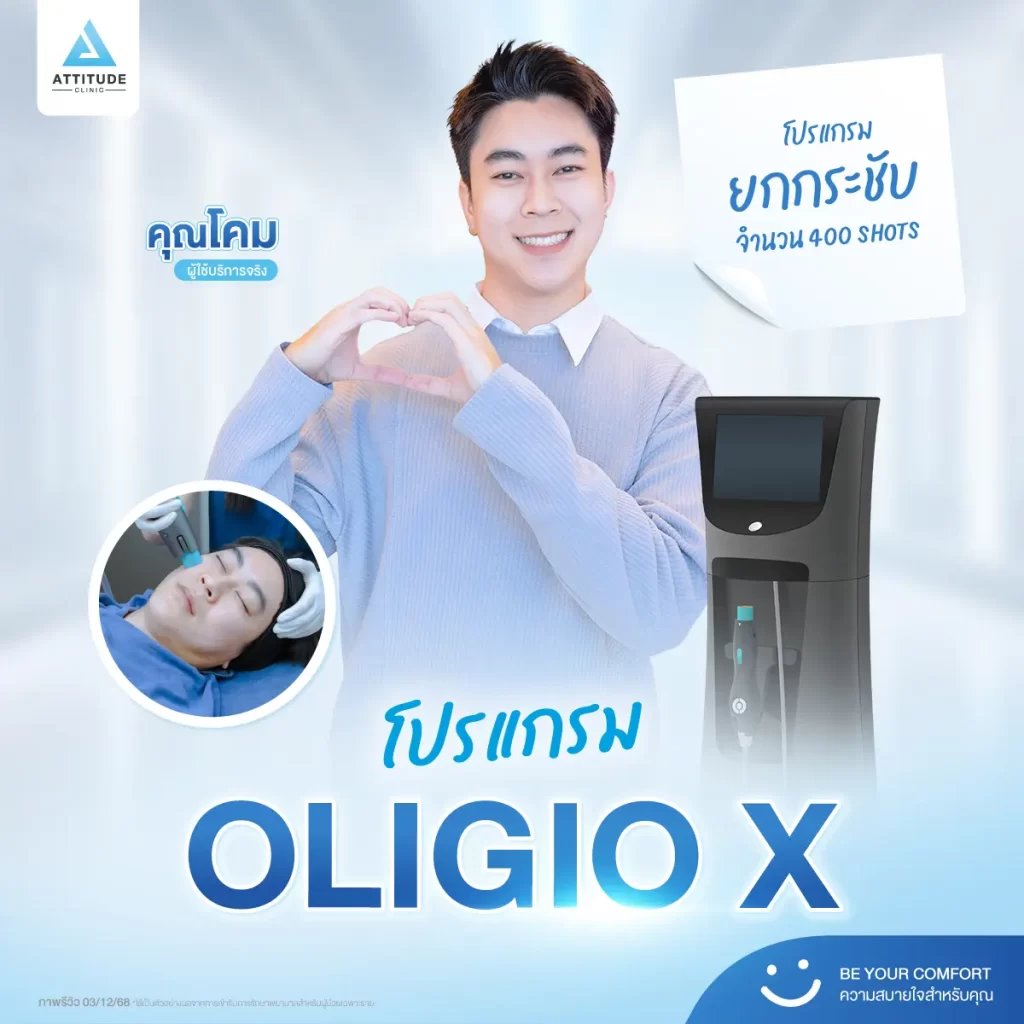 รีวิวโปรแกรมยกกระชับ Oligio X ของพี่โคม จำนวน 400 shot หลังทำ 30 นาที ยกกระชับผิว เก็บกรอบหน้าที่ ATTITUDE CLINIC