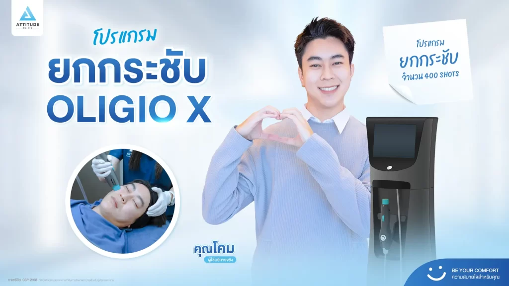 รีวิวโปรแกรมยกกระชับ Oligio X ของพี่โคม จำนวน 400 shot หลังทำ 30 นาที ยกกระชับผิว เก็บกรอบหน้าที่ ATTITUDE CLINIC