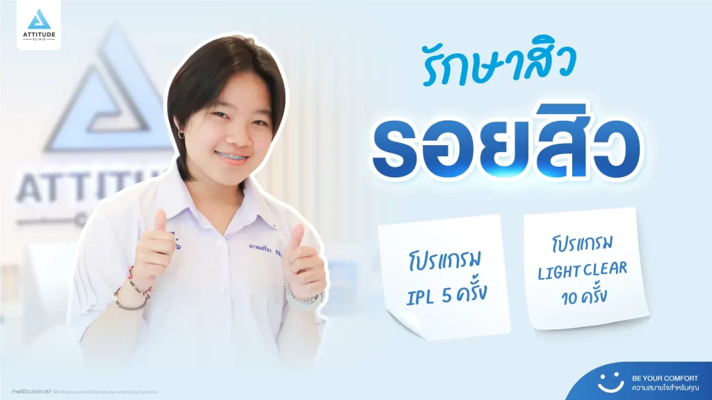 รีวิวรักษาสิวพี่อิง โปรแกรม Light Clear รักษาสิวด้วยการฉายแสง จำนวน 10 ครั้ง ต่อด้วยโปรแกรม IPL รักษารอยสิว จำนวน 5 ครั้งที่ Attitude Clinic