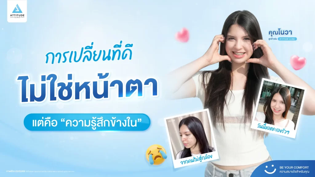 สิ่งที่เปลี่ยนไป ไม่ใช่ใบหน้า… แต่คือความมั่นใจ