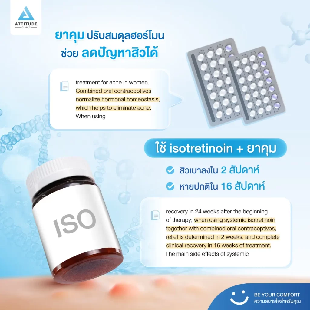 วิจัยเผยยาคุมกำเนิดช่วยลดสิวได้ ถ้าใช้ร่วมกับสิ่งนี้!