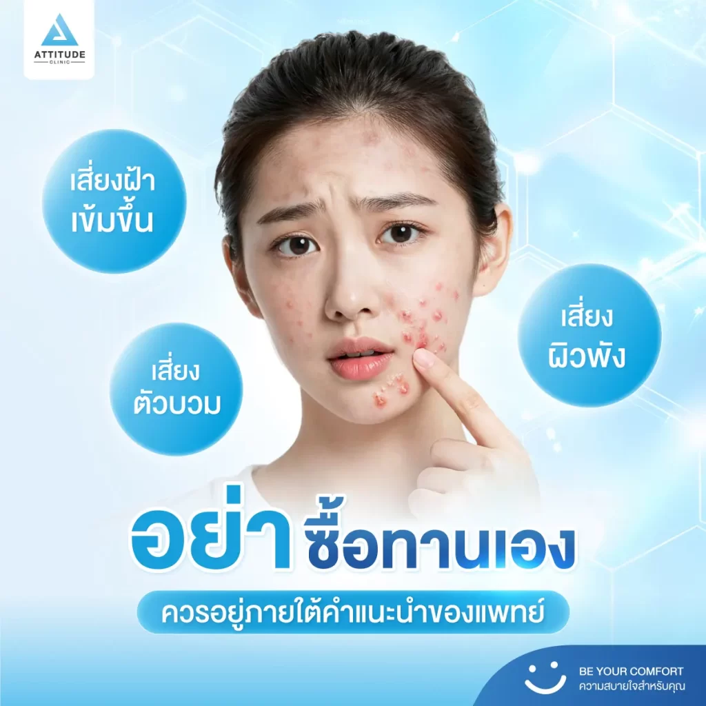 วิจัยเผยยาคุมกำเนิดช่วยลดสิวได้ ถ้าใช้ร่วมกับสิ่งนี้!