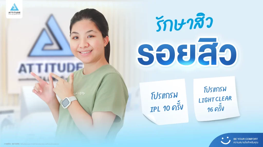 รีวิวรักษาสิวพี่นันท์นภัส โปรแกรม Light Clear รักษาสิวด้วยการฉายแสง จำนวน 16 ครั้ง ต่อด้วยโปรแกรม IPL รักษารอยสิว จำนวน 10 ครั้งที่ Attitude Clinic