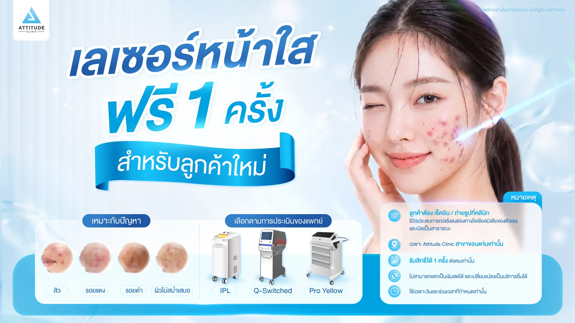 ขอนแก่นเตรียมแตก! ลูกค้าใหม่ทำเลเซอร์ฟรี แค่มาเซอร์เวย์ที่ Attitude Clinic