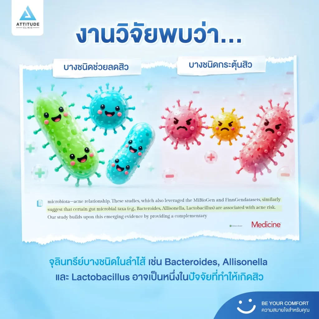 หยุดวงจรสิว แบบไม่ต้องจ่ายแพง เริ่มง่าย ๆ แค่ดูแลลำไส้