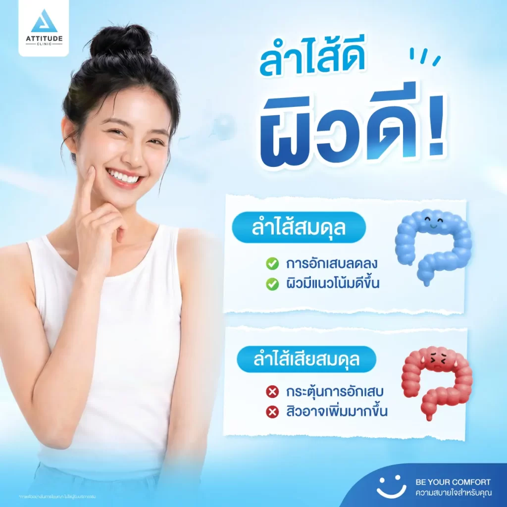 หยุดวงจรสิว แบบไม่ต้องจ่ายแพง เริ่มง่าย ๆ แค่ดูแลลำไส้