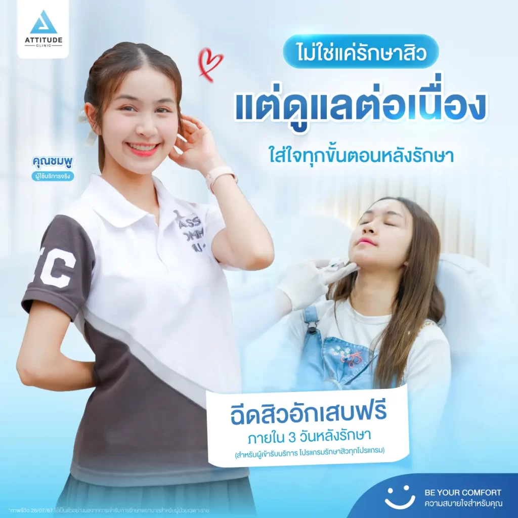 รักษาสิวที่แอททิจูด ไม่ใช่จบแค่ในคลินิก เพราะเราดูแลต่อเนื่องหลังการรักษาจนกว่าผิวคุณจะดีขึ้น