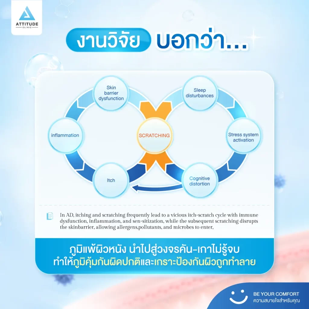 ต้องระวัง! อาการยิ่งเกายิ่งคัน อาจเป็นสัญญาณบอก ‘โรคภูมิแพ้ผิวหนัง’