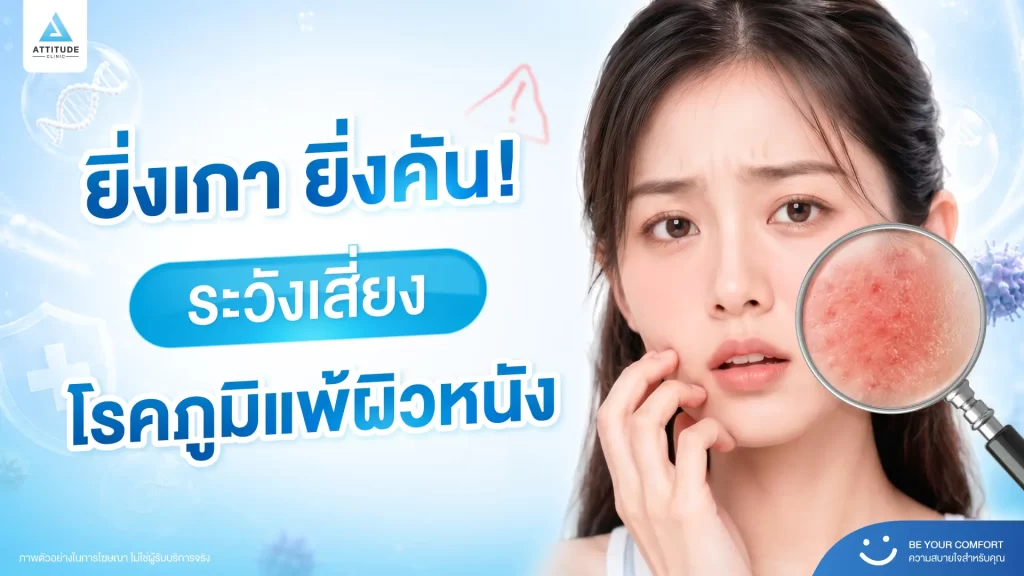 ต้องระวัง! อาการยิ่งเกายิ่งคัน อาจเป็นสัญญาณบอก ‘โรคภูมิแพ้ผิวหนัง’